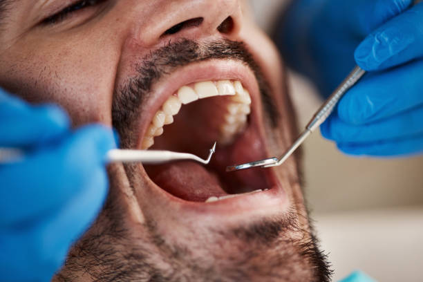 Best Emergency Dental Care for Broken or Chipped Teeth in Sughter, LA
